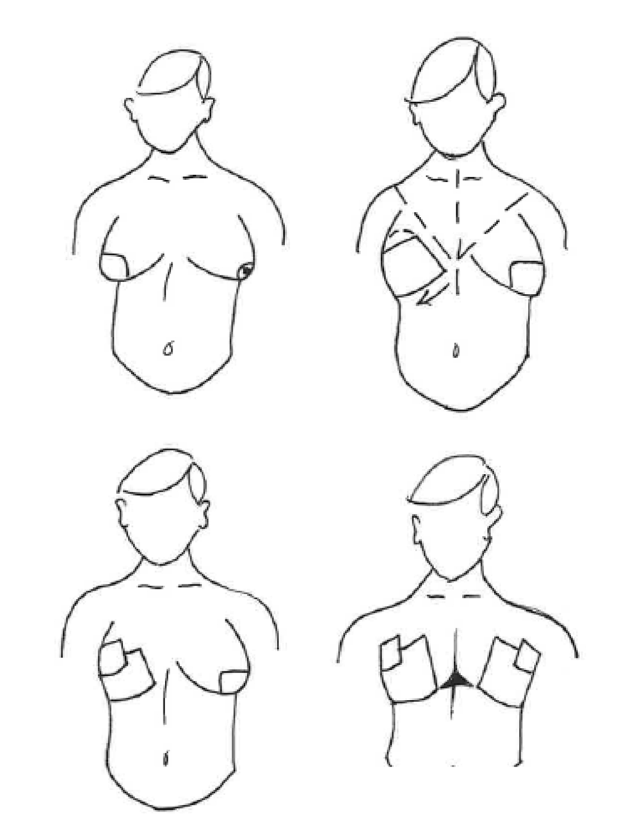 Urban Dictionary on X: @TEDDDAYYY nipple blades: When your